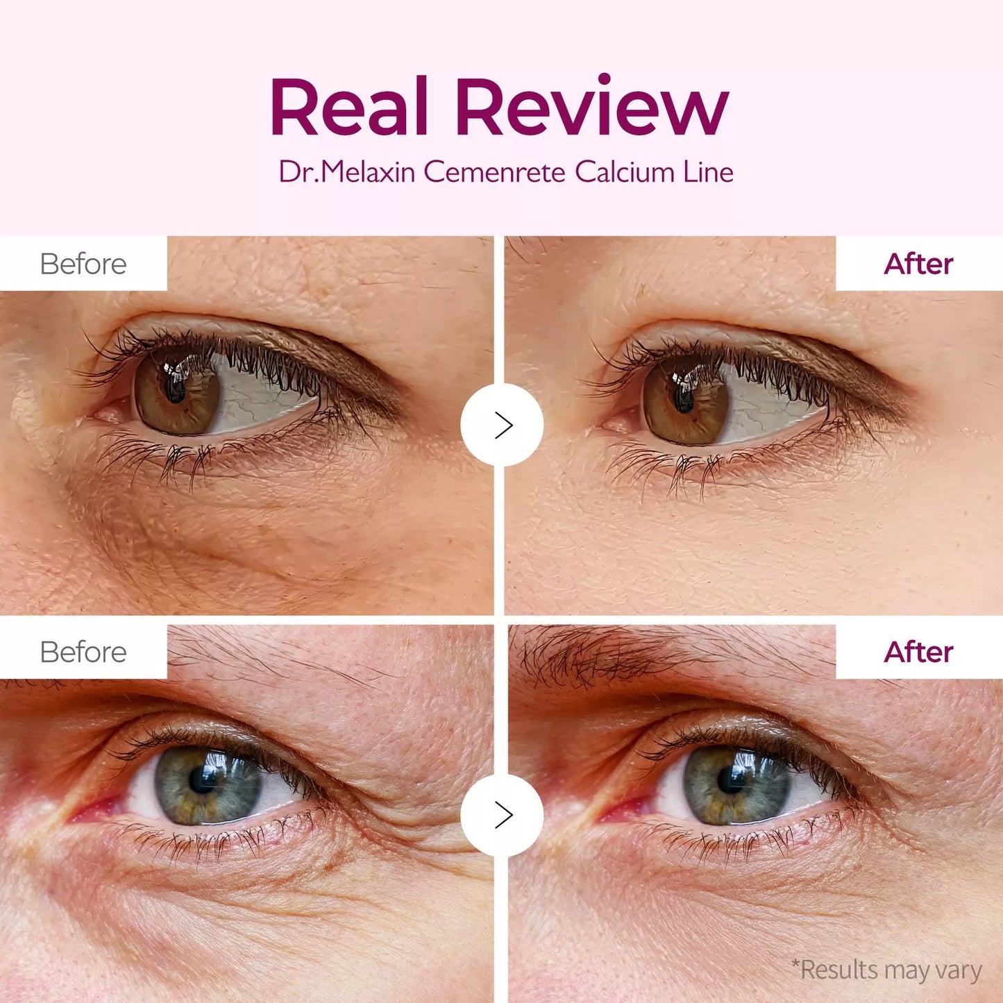 Cemenrete Calcium Volume Eye Patch
