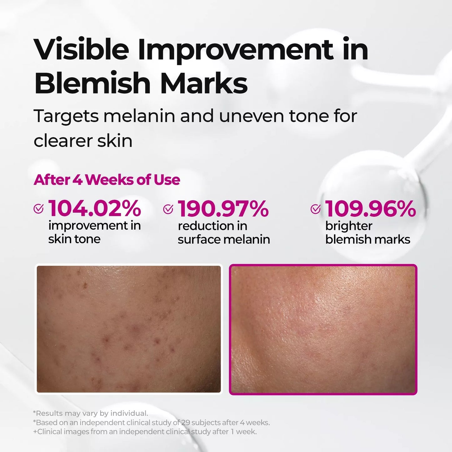 Picotonic Shot Pigmentation Serum
